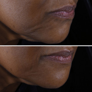 Smart Clinical Repair - Straffende Gesichts- und Halscreme